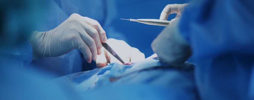 What is General Surgery