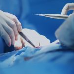 What is General Surgery