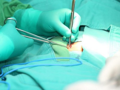 the-pros-and-cons-of-laparoscopic-surgery-vs-open-surgery-for-hernia-repair-doctor